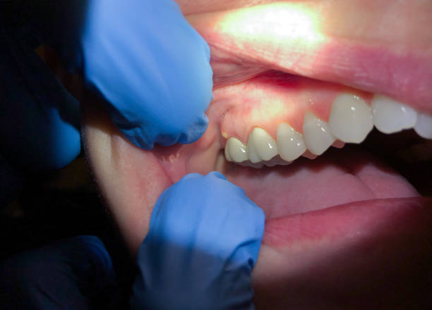 Best Pediatric Emergency Dentist in Merrydale, LA