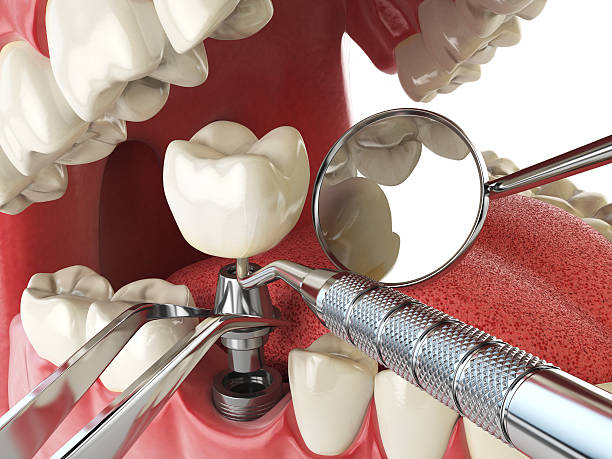 Best Emergency Treatment for Toothache in Merrydale, LA